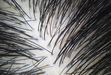 TRICOLOGIA